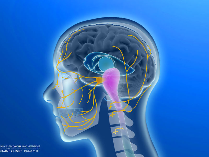 Brisbane Headache and Migraine Clinic - Spring Hill image